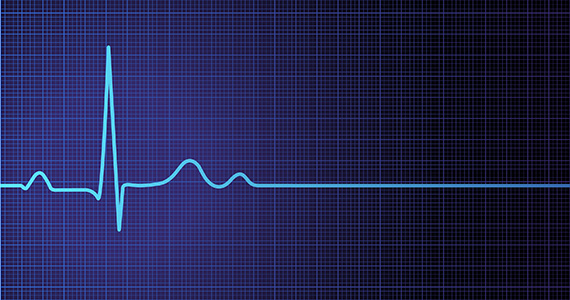 ecg